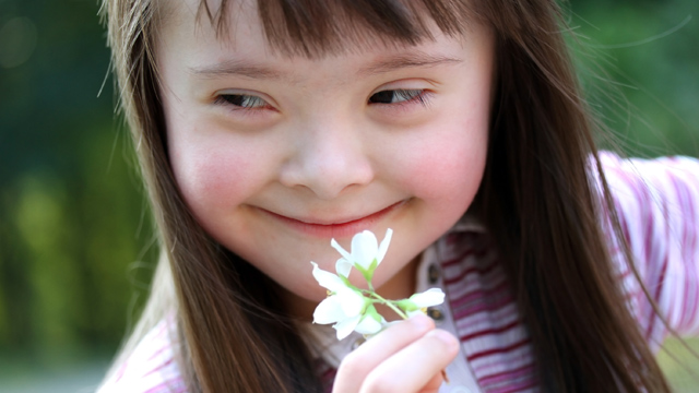 171384-down-syndrome
